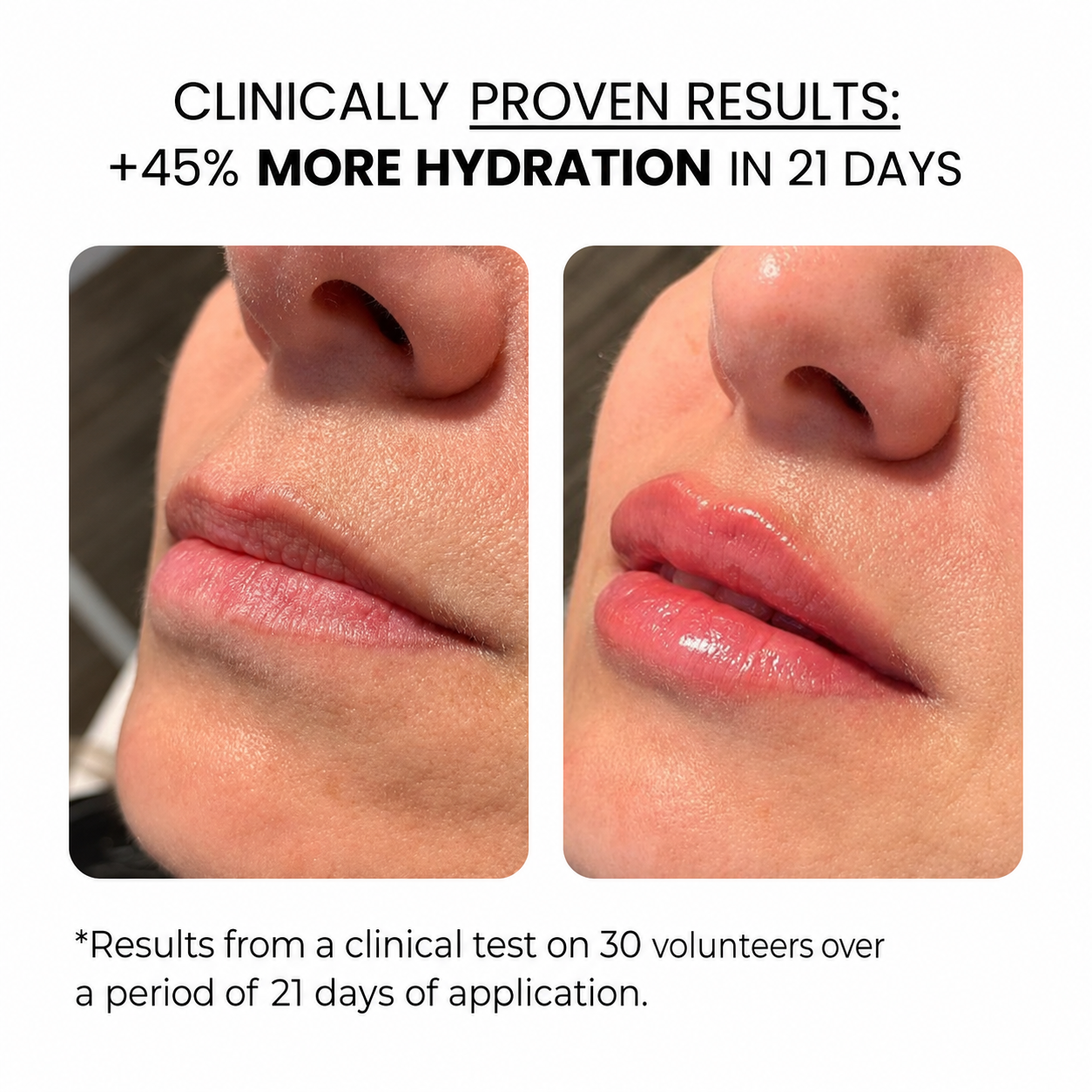 Lip Treatment | HAMINOS®