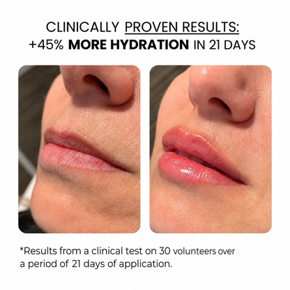 Lip Treatment | HAMINOS®